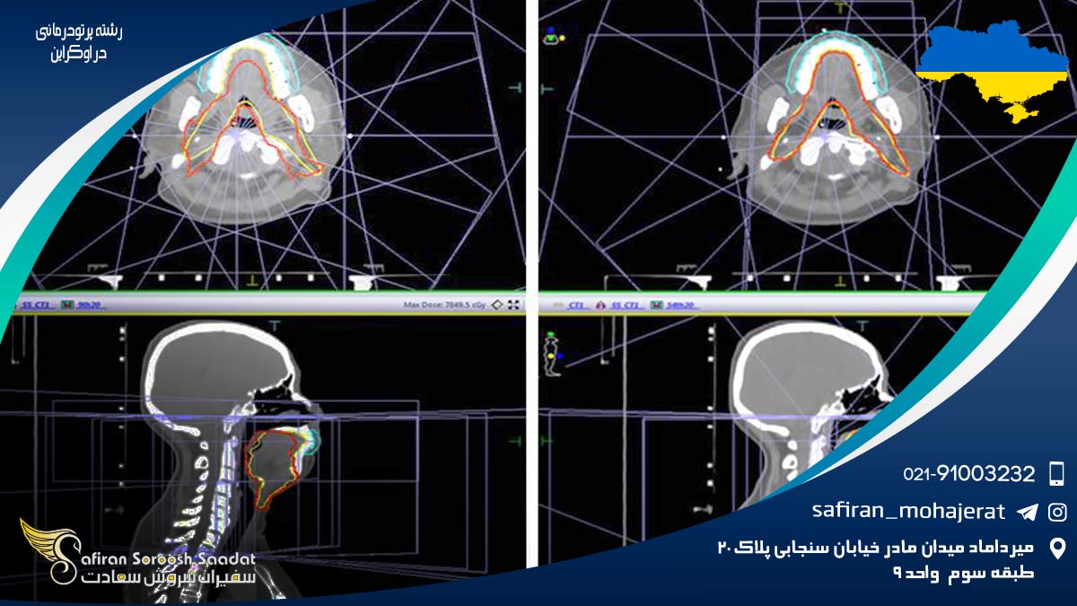 رشته پرتودرمانی در اوکراین